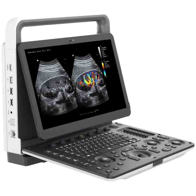 Ecograf doppler color portabil Zoncare M70