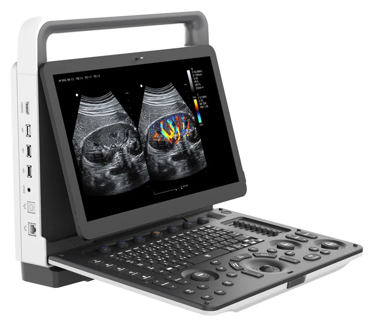 ecograf doppler color Zoncare M70 Ecograf doppler color portabil Zoncare M70