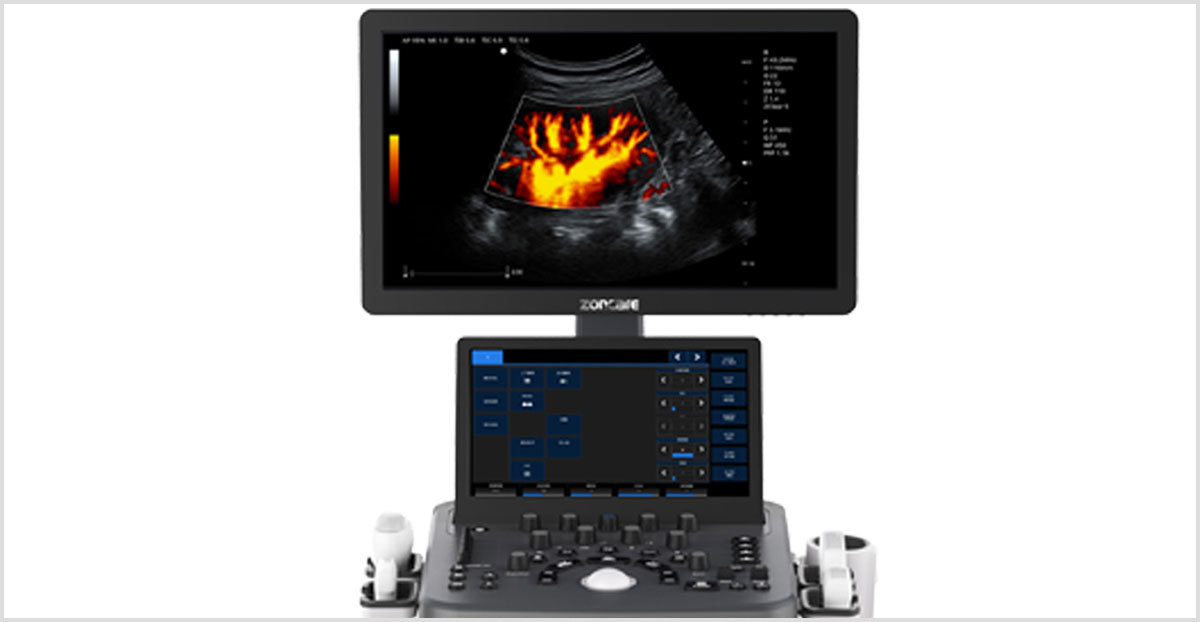 ecograf doppler color zoncare viv20 3 Ecograf Doppler Color Zoncare VIV20