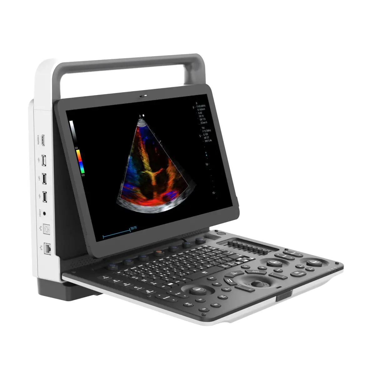 ecograf zoncare M30 Ecograf doppler color portabil Zoncare M30