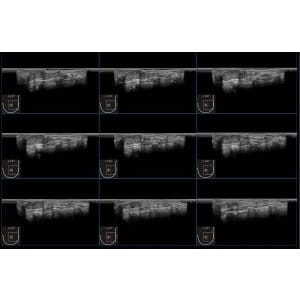 Ecograf Doppler color IBUS 60