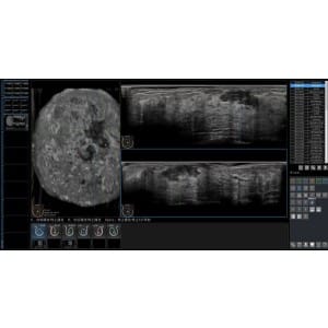 Ecograf Doppler color IBUS 60