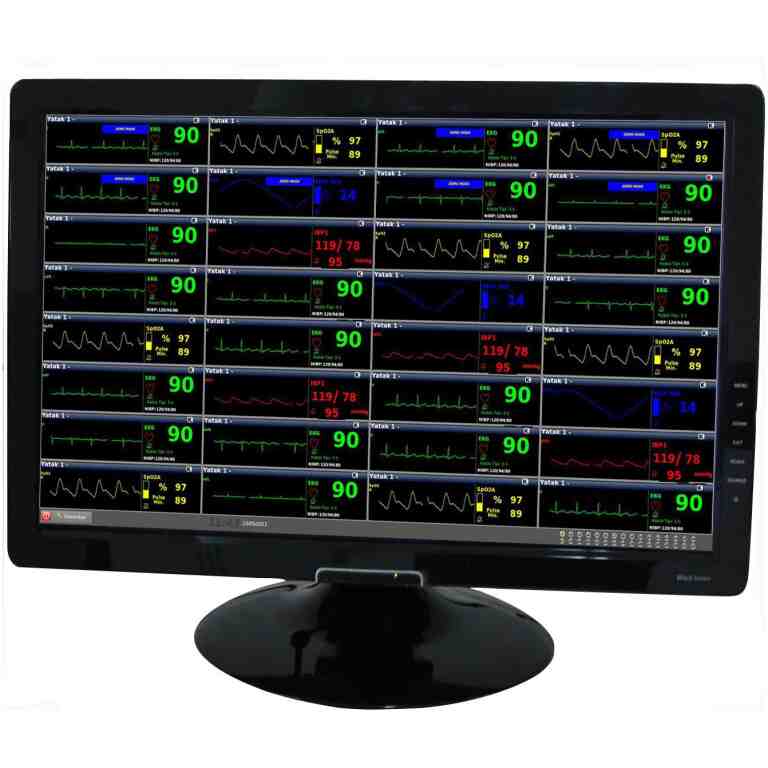 Software statie centrala monitor functii vitale