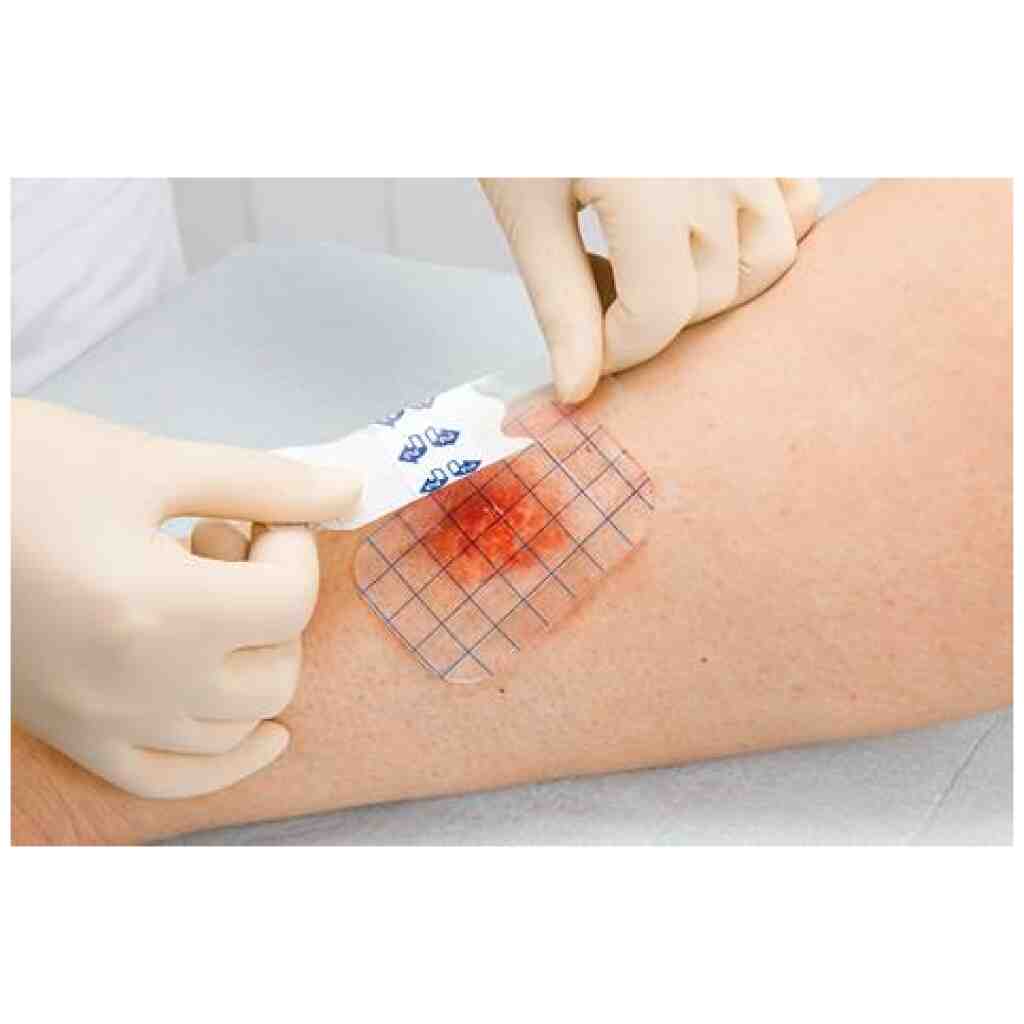 Гелепран повязка гидрогелевая. Повязка хартман гидросорб шприц-гель. Раневое покрытие гелепран. Гидрогелевая повязка для лечения. Хартман гидротак.