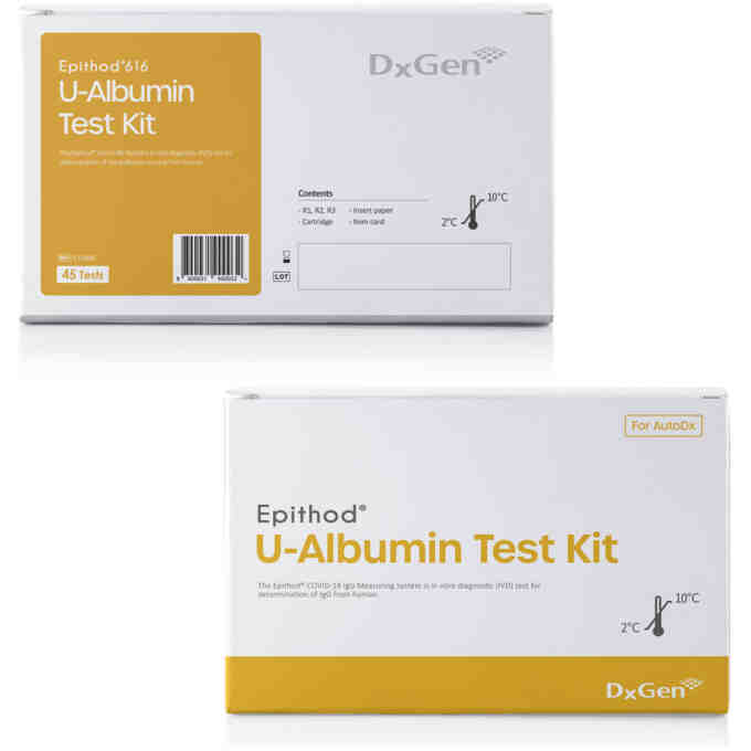 Teste U-albumina Epithod