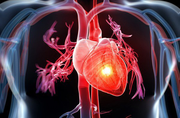 Angiografie coronariană: Tot ce trebuie să știi despre investigația cardiacă minim invazivă