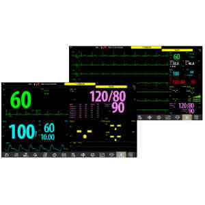 Monitor pacienti Witleaf W12