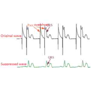 Monitor capnografie portabil Witleaf WIT-S300