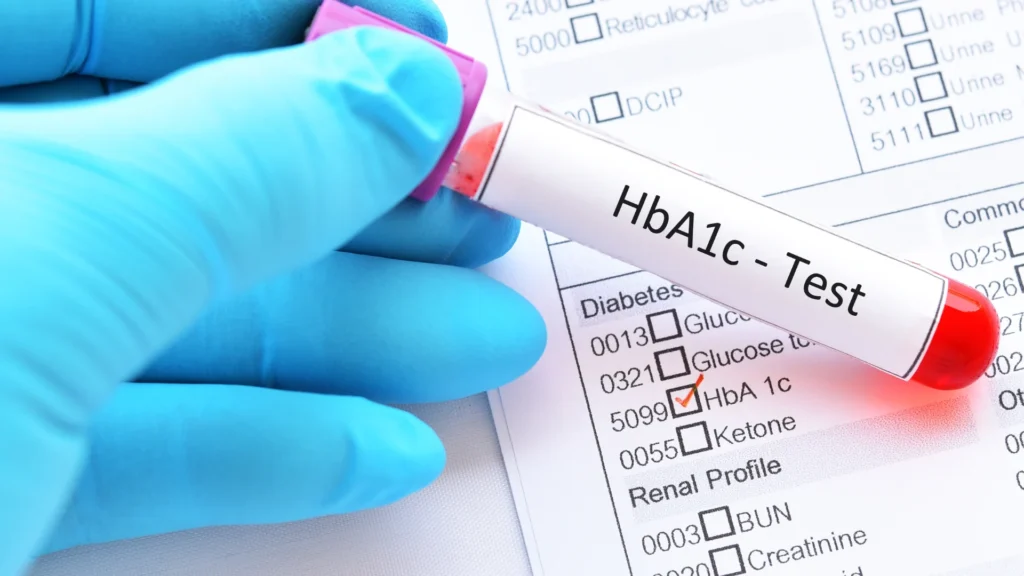 Calculator HbA1c – Estimează media glicemiei pe ultimele 3 luni